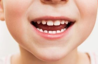 Неприятный запах изо рта у детей — симптомы и лечение